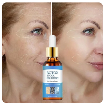 PAGA 1 Y LLEVA 2! 💧Serum antiedad BotoxLux™ solución definitiva para arrugas y marcas de edad