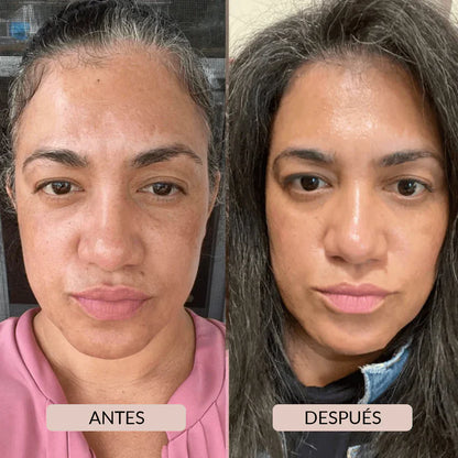 💧PAGA 1 Y LLEVA 2 MASCARILLAS DE BIOCOLÁGENO EN SU MÁXIMA POTENCIA: DESPIERTA CON UNA PIEL JOVEN Y RADIANTE ✨💖