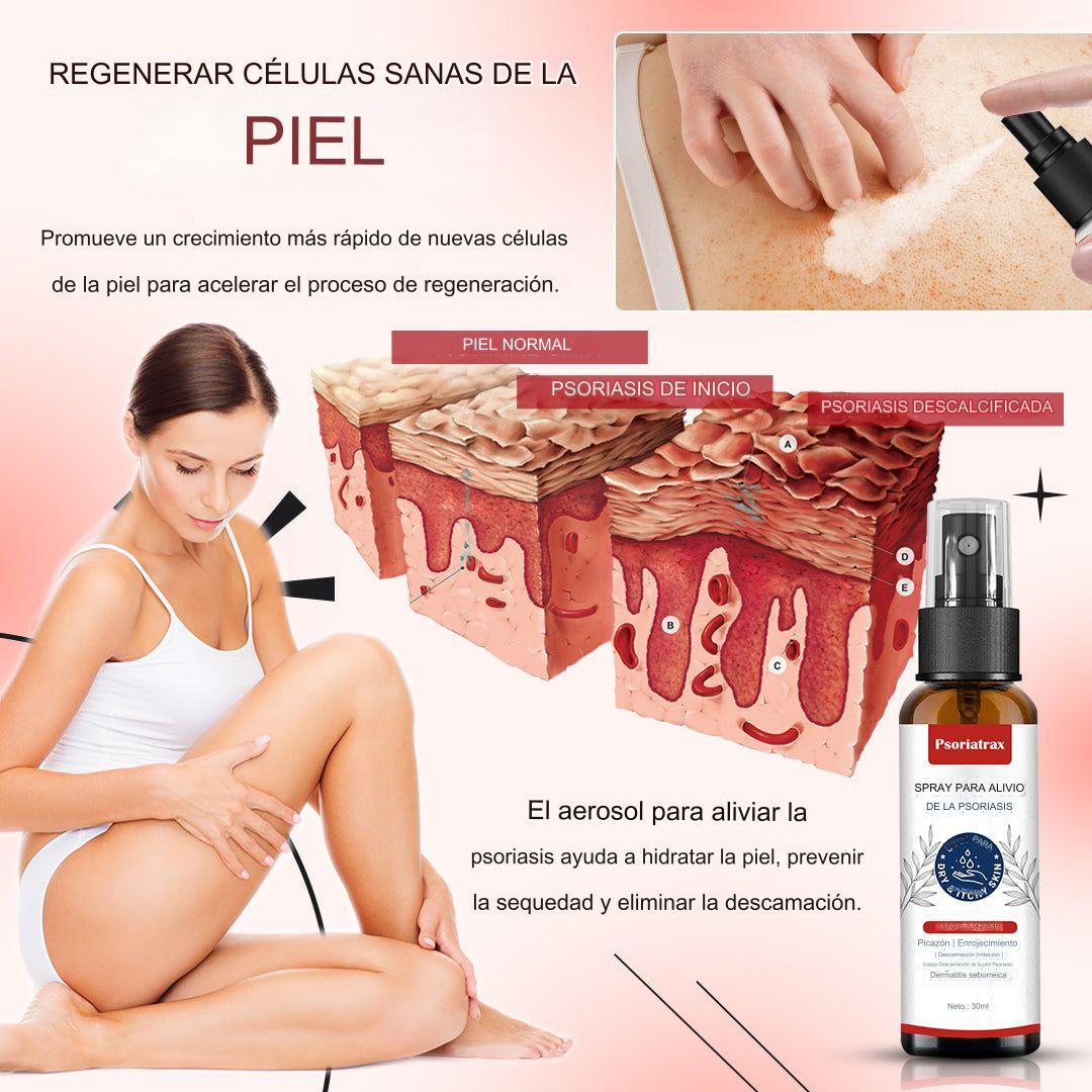 🚨 KOLMAX TRATAMIENTO EFECTIVO CONTRA LA PSORIASIS, DESCAMACIÓN, ENROJECIMIENTO Y DERMATITIS.