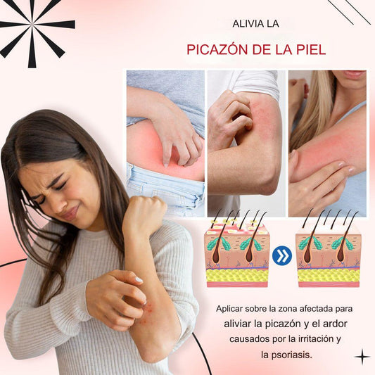 🚨 KOLMAX TRATAMIENTO EFECTIVO CONTRA LA PSORIASIS, DESCAMACIÓN, ENROJECIMIENTO Y DERMATITIS.